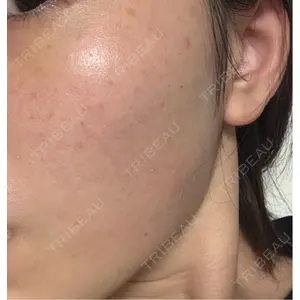 ミニマムスキンクリニック ミニマムスキンクリニック池袋口コミ