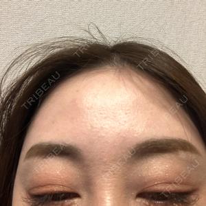 エルムクリニック 美容皮膚科エルムクリニック 福岡院口コミ