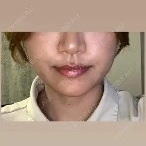 APスキンクリニック銀座口コミ