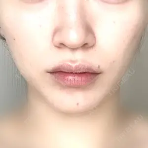 CZEN CLINIC 銀座院口コミ