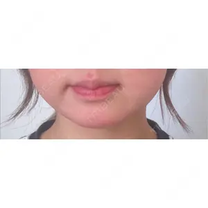 プロクリニック PRO CLINIC プロクリニック 銀座院口コミ