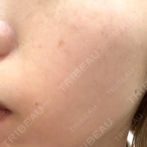 NARU Beauty Clinic NARU Beauty Clinic 【ナルクリ】口コミ