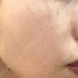 NARU Beauty Clinic NARU Beauty Clinic 【ナルクリ】口コミ