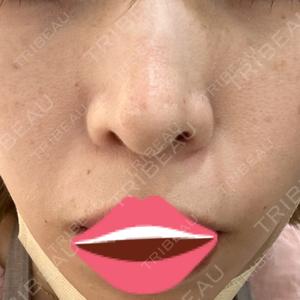 NARU Beauty Clinic NARU Beauty Clinic 【ナルクリ】口コミ