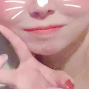 ブルームクリニック（BLOOM CLINIC）口コミ