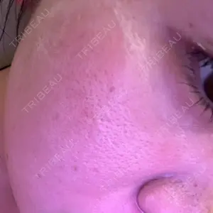 ルラ美容クリニック ルラ美容クリニック 福岡本院口コミ