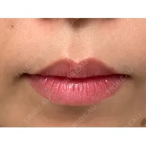 L‘amour clinic Tokyo【ラムールクリニック東京】口コミ