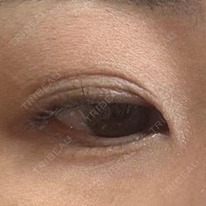 NARU Beauty Clinic NARU Beauty Clinic 【ナルクリ】口コミ