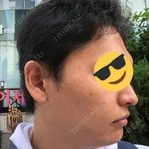 グロービー美容整形外科口コミ