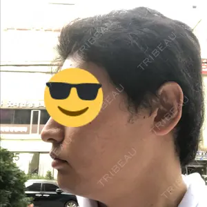 グロービー美容整形外科口コミ