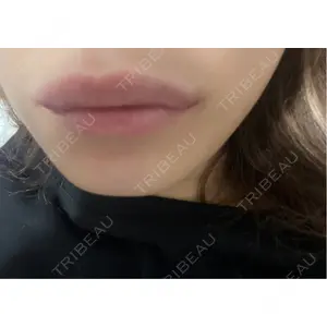 ルラ美容クリニック ルラ美容クリニック 高田馬場院口コミ