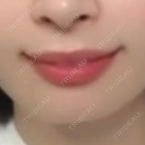 TCB東京中央美容外科 TCB東京中央美容外科 札幌駅前院口コミ