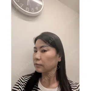 TCB東京中央美容外科 TCB東京中央美容外科 松山院口コミ