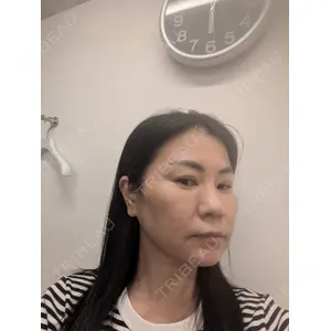 TCB東京中央美容外科 TCB東京中央美容外科 松山院口コミ