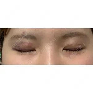 Leap beauty clinic口コミ