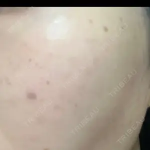 ルラ美容クリニック ルラ美容クリニック 福岡本院口コミ