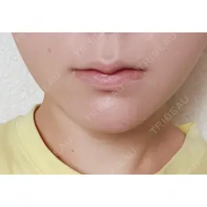 口コミ