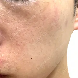 おおかみ美容のクリニック おおかみ美容のクリニック 新宿院口コミ