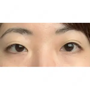 ジュエリー美容外科口コミ