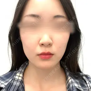 plume clinic plume clinic口コミ