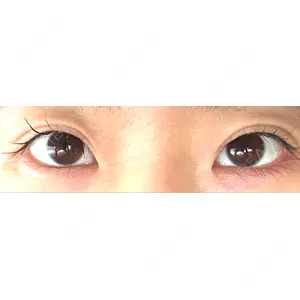 BIANCA CLINIC BIANCA銀座口コミ