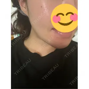 TCB東京中央美容外科 TCB東京中央美容外科 京都四条院口コミ