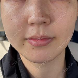 ルラ美容クリニック ルラ美容クリニック 静岡院口コミ