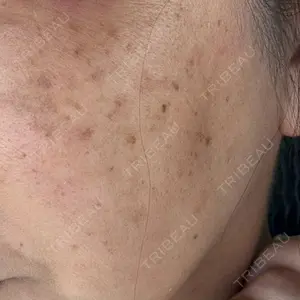 ルラ美容クリニック ルラ美容クリニック 名古屋本院口コミ