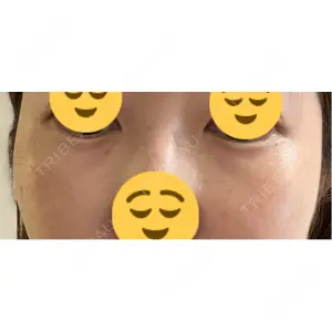 プラストクリニック口コミ