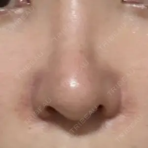 口コミ