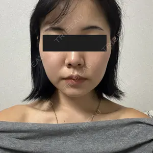 TCB東京中央美容外科 TCB東京中央美容外科 浜松院口コミ