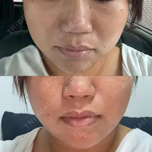 ルラ美容クリニック ルラ美容クリニック 広島院口コミ