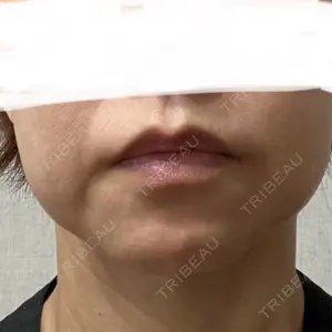 椿クリニック 椿クリニック 心斎橋院口コミ