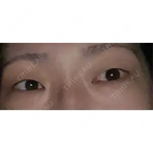 東京ココセランクリニック口コミ