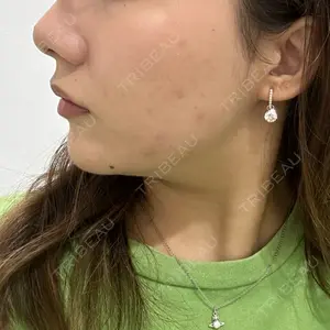 TCB東京中央美容外科 TCB東京中央美容外科 神戸院口コミ