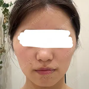 CZEN CLINIC 銀座院口コミ
