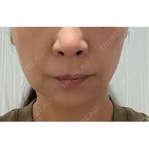 ゆきスキンクリニック 東池袋口コミ