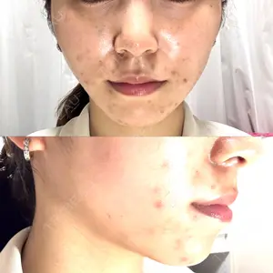 TCB東京中央美容外科 TCB東京中央美容外科 大宮東口院口コミ