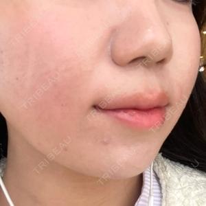 TCB東京中央美容外科 TCB東京中央美容外科 那覇院口コミ