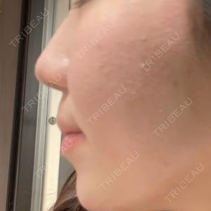 TCB東京中央美容外科 TCB東京中央美容外科 那覇院口コミ