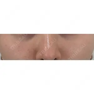 銀座リシェスクリニック口コミ