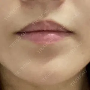 フィラークリニック フィラークリニック 大阪梅田院口コミ