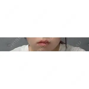 共立美容外科・歯科 共立美容外科 梅田院口コミ