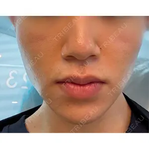 ルラ美容クリニック ルラ美容クリニック 池袋院口コミ