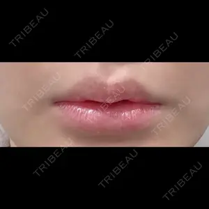 R Beauty CLINIC R Beauty CLINIC 銀座院口コミ