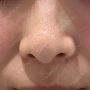 トラスト美容クリニック トラスト美容クリニック 銀座院口コミ