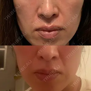 ルラ美容クリニック ルラ美容クリニック 渋谷本院口コミ