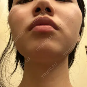 ルラ美容クリニック ルラ美容クリニック 渋谷本院口コミ