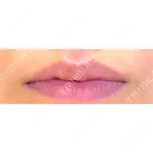 LOUIS CLINIC 二子玉川院【ルイクリニック】口コミ