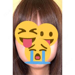 TCB東京中央美容外科 TCB東京中央美容外科 三島院口コミ